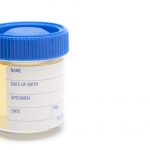 Urine Sample in clear container with blue lid
