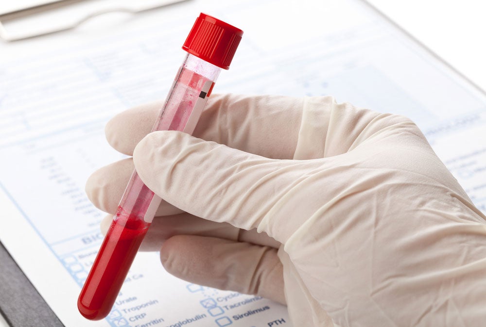 Endometriosis Might be Determined By Blood Test