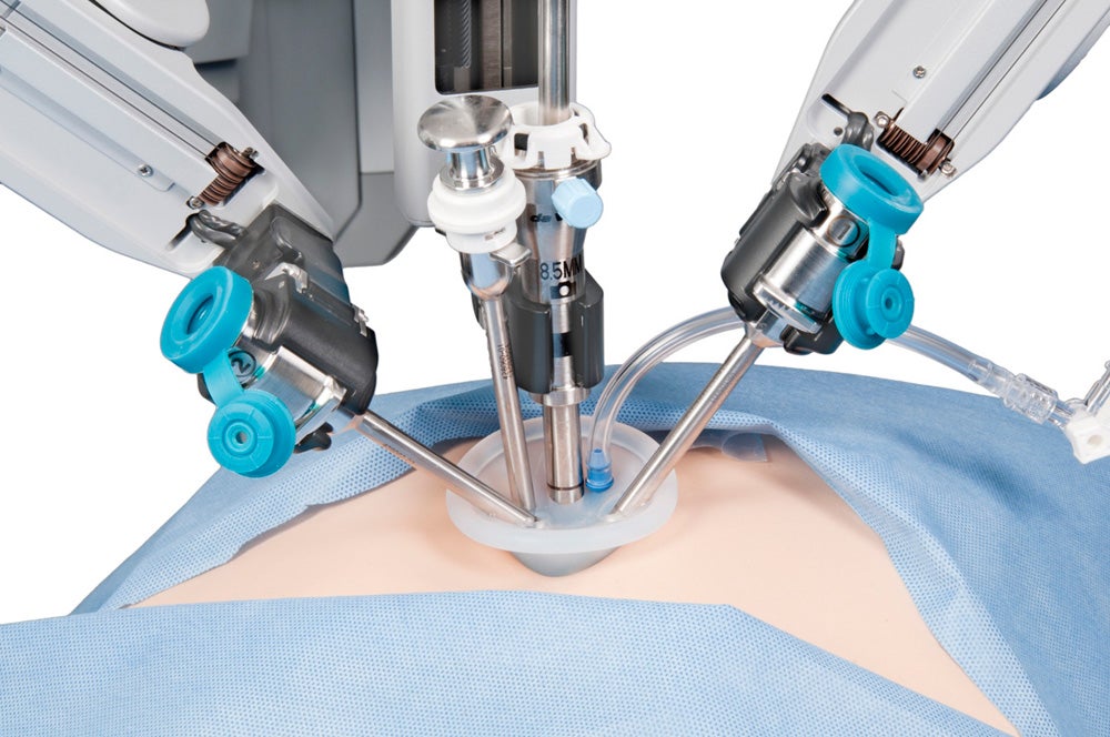 First Single-Site Robot-assisted Hysterectomy at Clear Lake Regional
