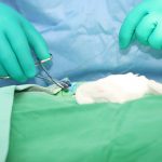 doctor wearing a gloves while doing a suture