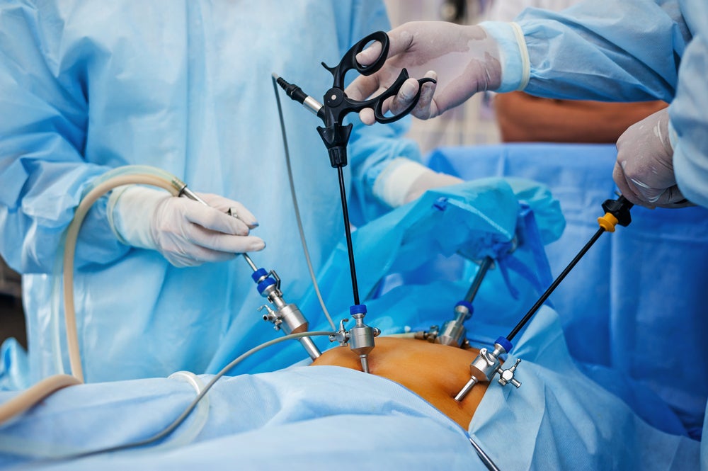 Hysterectomy no longer only option for treating fibroids