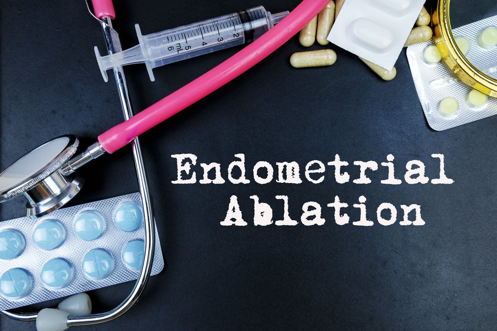 Endometrial ablation doesn’t increase cancer risk