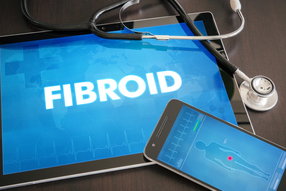 New Uterine Fibroids Oral Treatment Could Replace Surgery